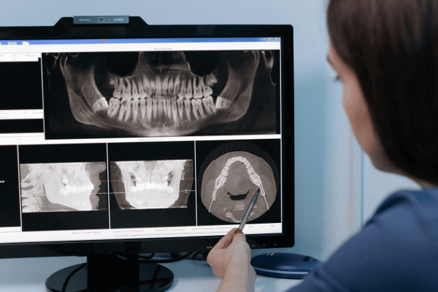 X-ray in a mobile dental clinic.